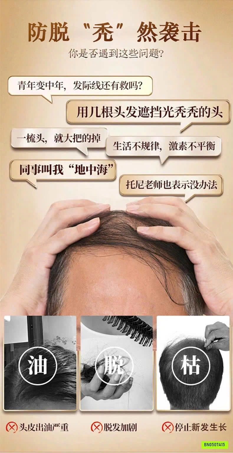 XỊT MỌC TÓC ĐÔNG NHÂN ĐƯỜNG