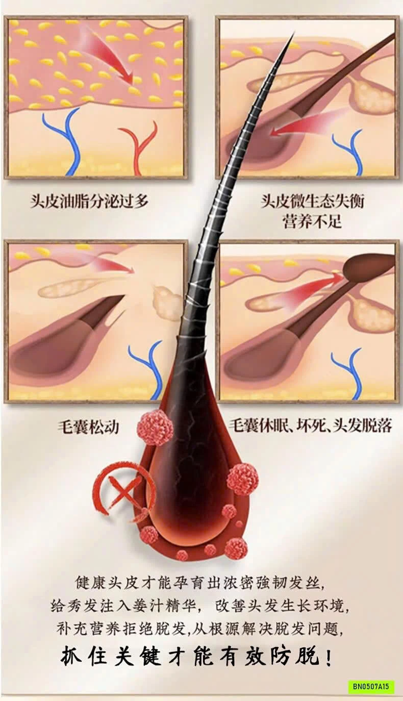 XỊT MỌC TÓC ĐÔNG NHÂN ĐƯỜNG
