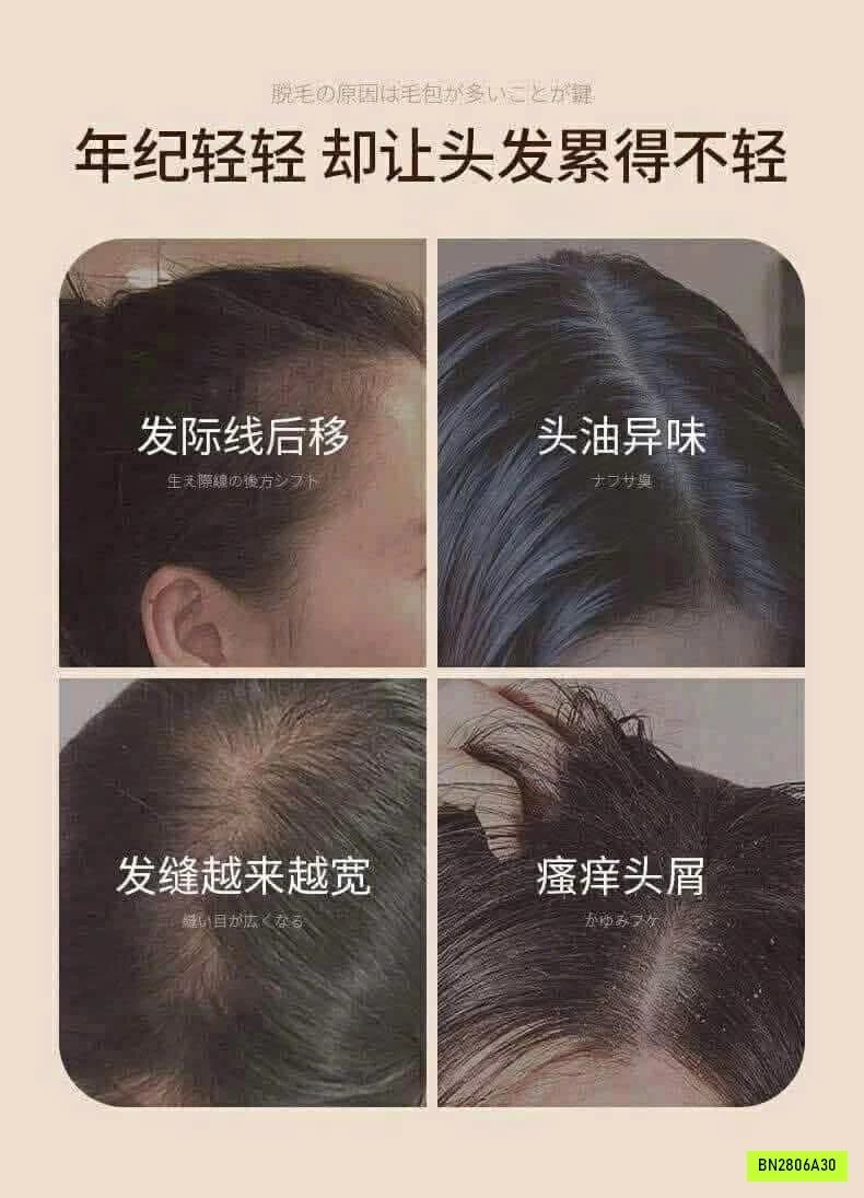 DẦU GỘI GỪNG GIẢM RỤNG TÓC CỦA #MOFAJANG