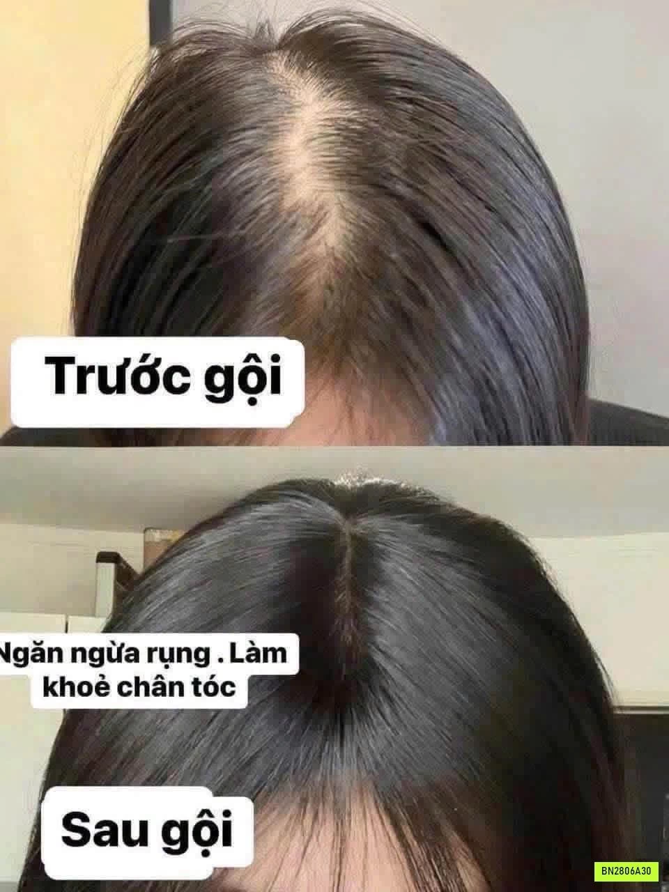 DẦU GỘI GỪNG GIẢM RỤNG TÓC CỦA #MOFAJANG